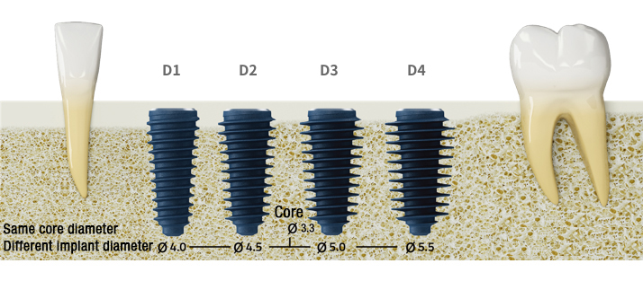 AR Croatia diameters
