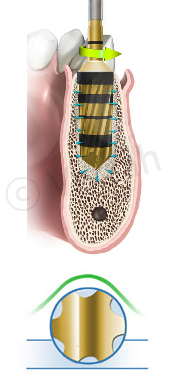 Densah103-1-2