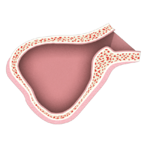 Sinus lift protocols